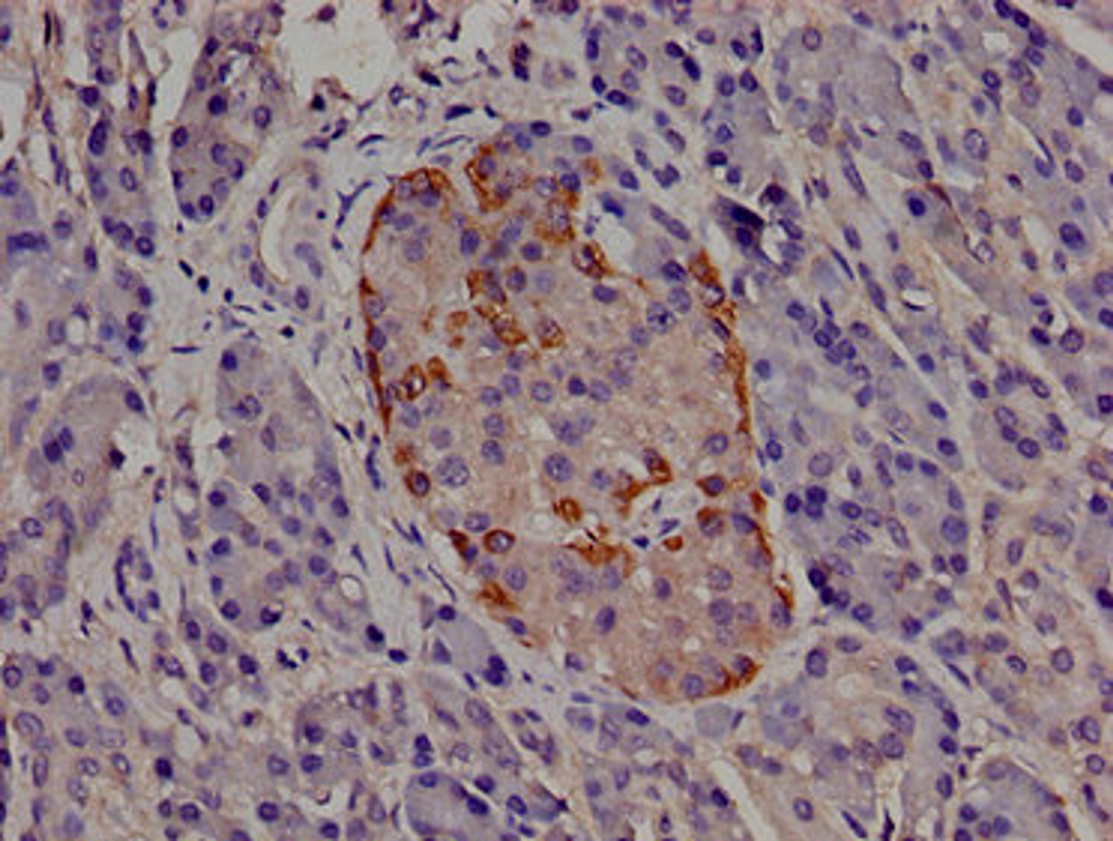 Immunohistochemistry of paraffin-embedded human pancreatic tissue using CSB-PA624029LA01HU at dilution of 1:100