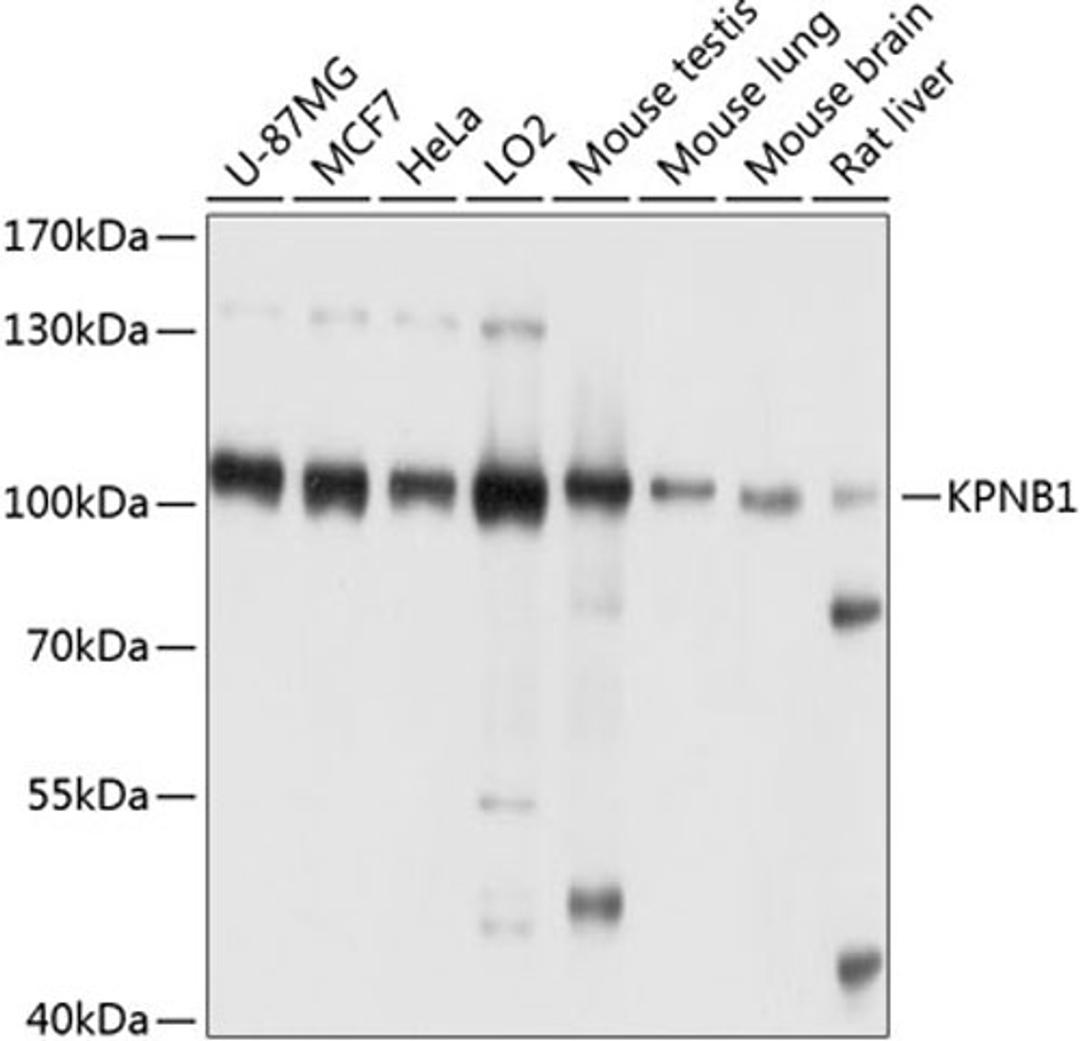 Western blot - KPNB1 antibody (A8610)