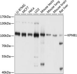 Western blot - KPNB1 antibody (A8610)