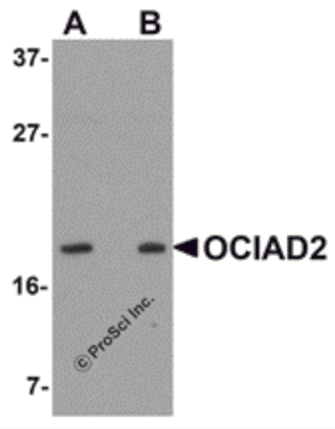 Western blot analysis of OCIAD2 in SK-N-SH cell lysate with OCIAD2 antibody at (A) 0.5 and (B) 1 μg/mL.