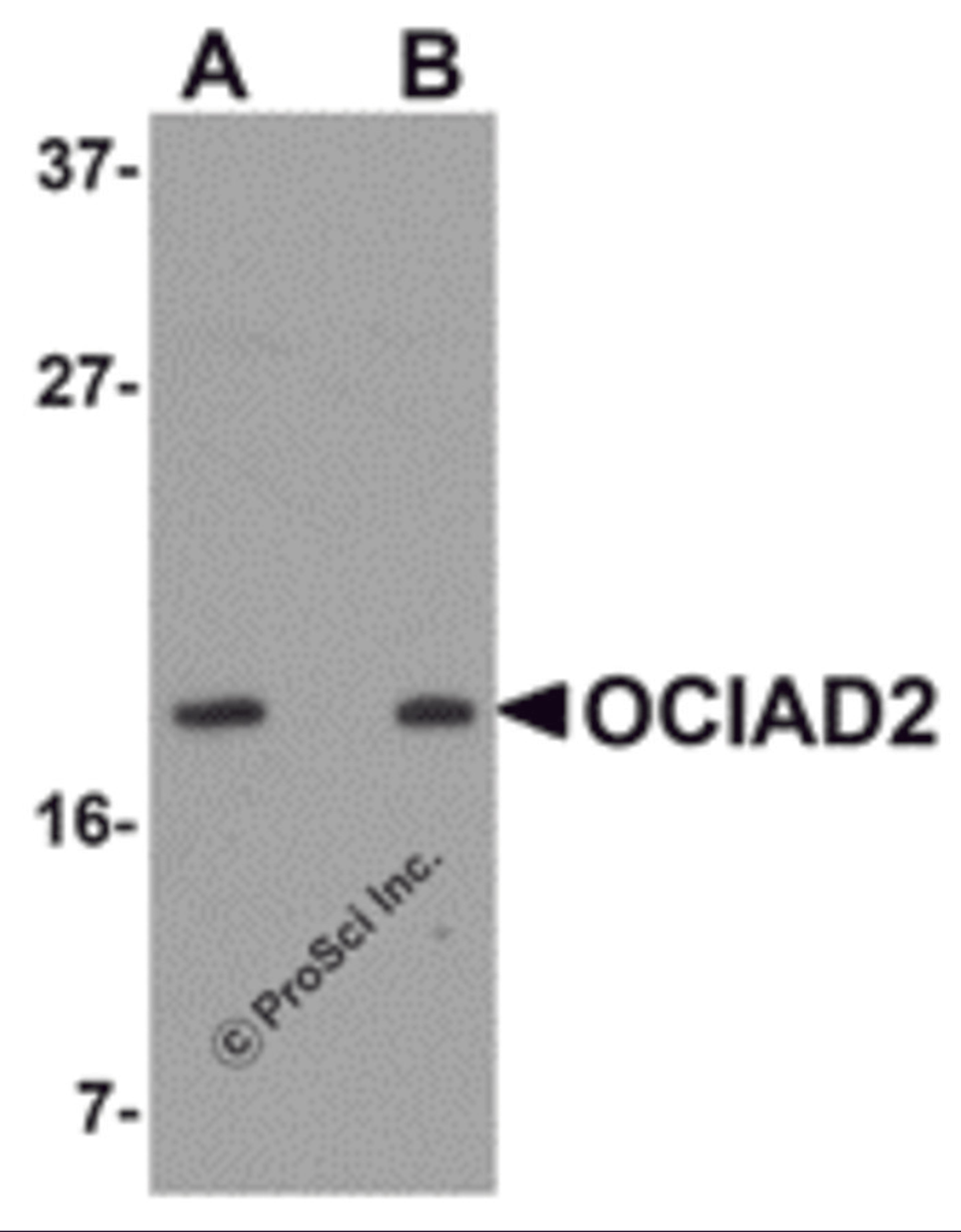 Western blot analysis of OCIAD2 in SK-N-SH cell lysate with OCIAD2 antibody at (A) 0.5 and (B) 1 μg/mL.