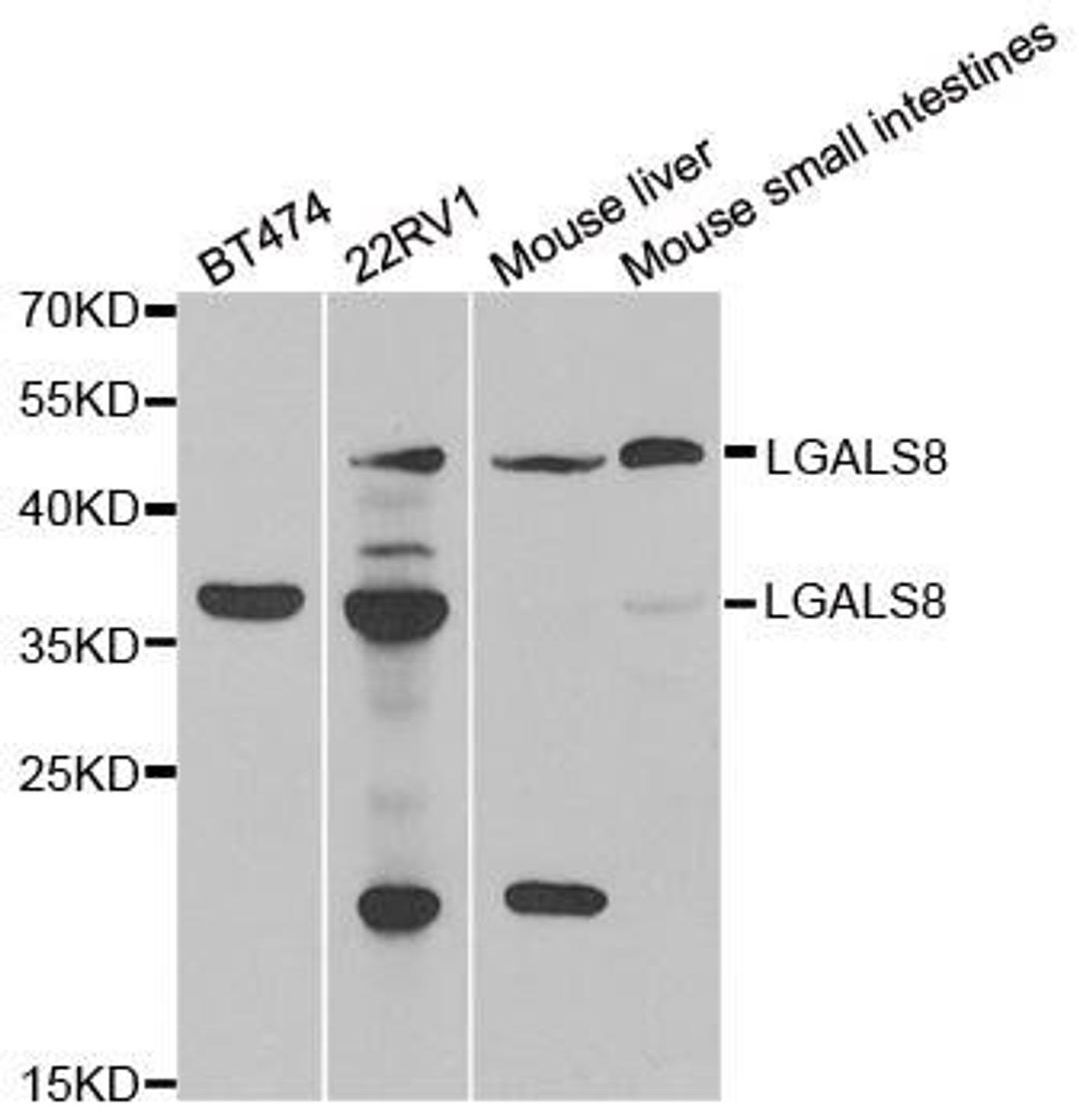 Western blot analysis of extracts of various cell lines using LGALS8 antibody