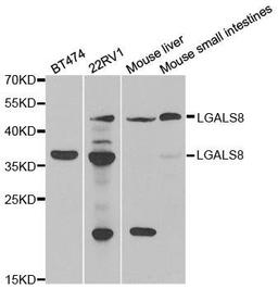 Western blot analysis of extracts of various cell lines using LGALS8 antibody