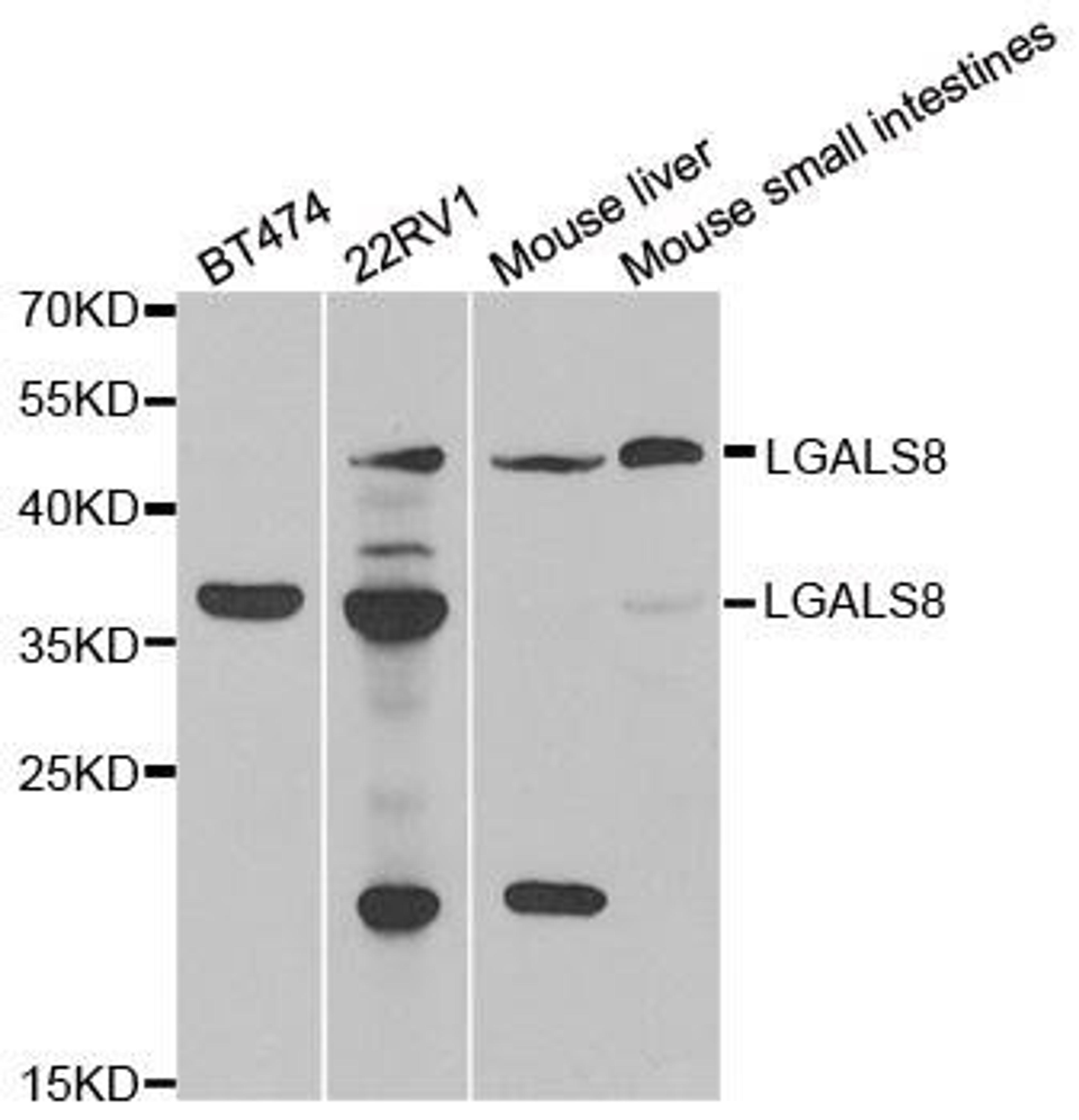 Western blot analysis of extracts of various cell lines using LGALS8 antibody