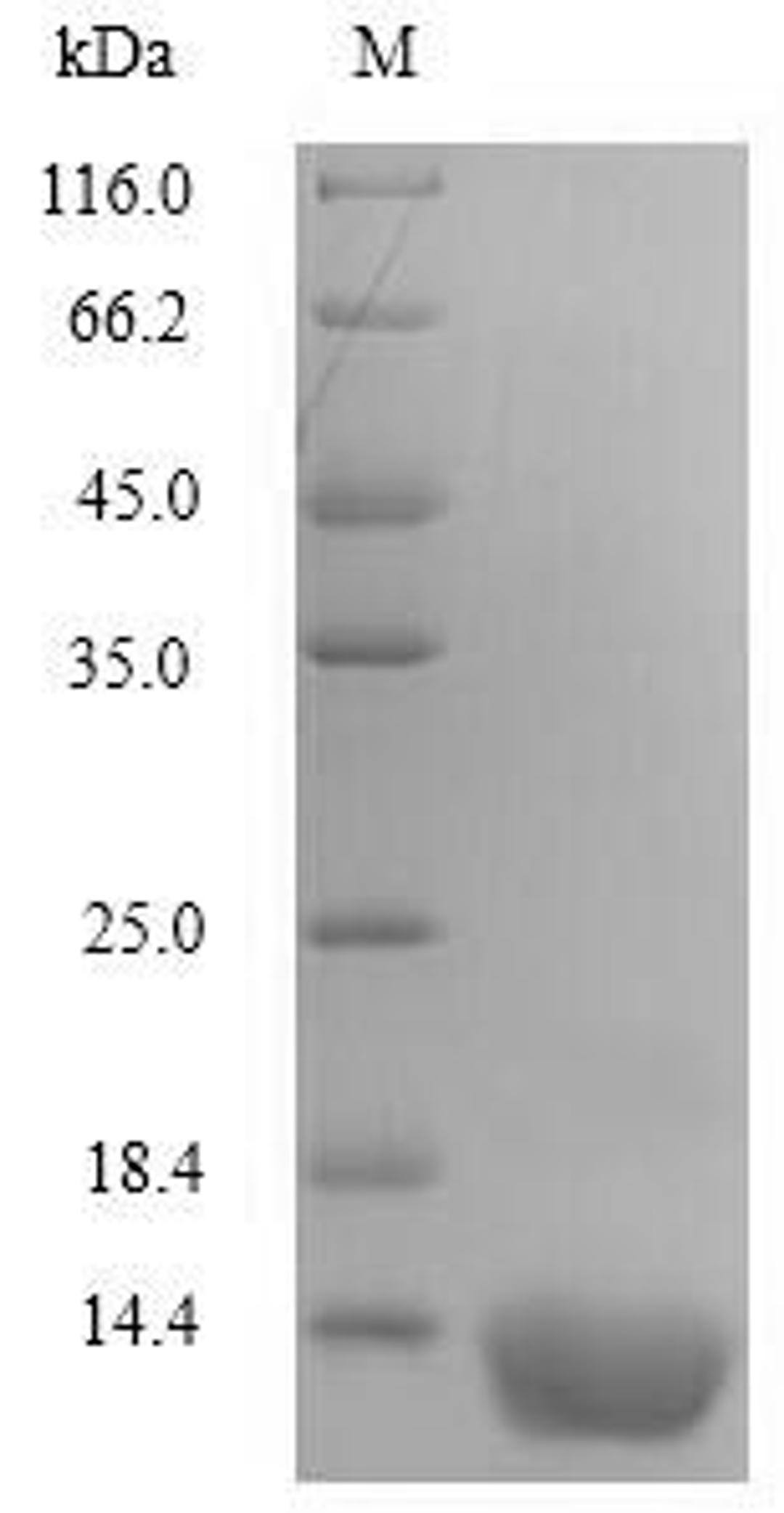 (Tris-Glycine gel) Discontinuous SDS-PAGE (reduced) with 5% enrichment gel and 15% separation gel.