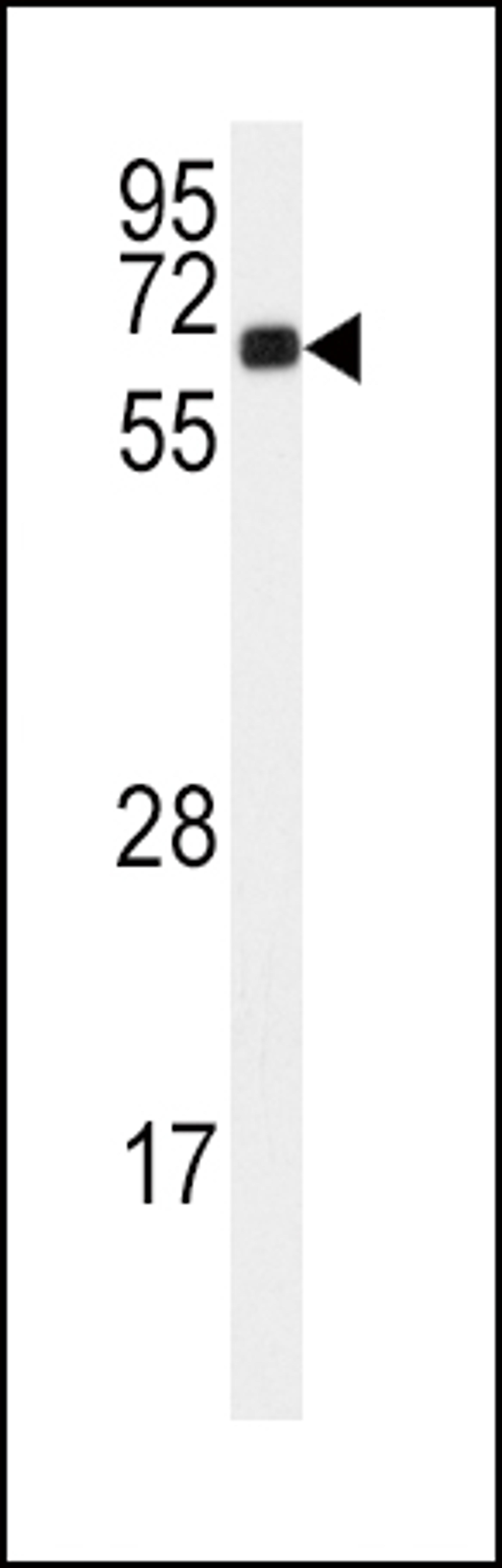 Western blot analysis of anti-C in 293 cell line lysates (35ug/lane).