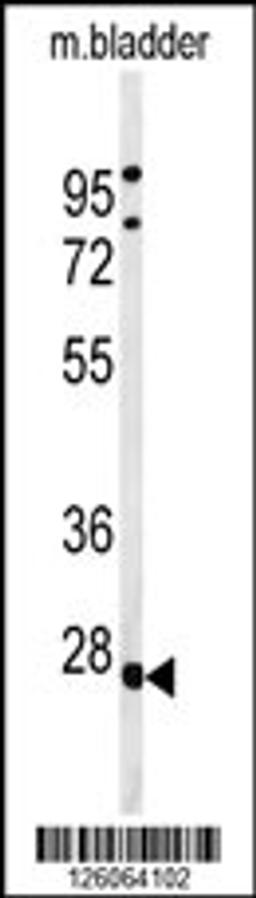 Western blot analysis of TPRGL Antibody in mouse bladder tissue lysates (35ug/lane)