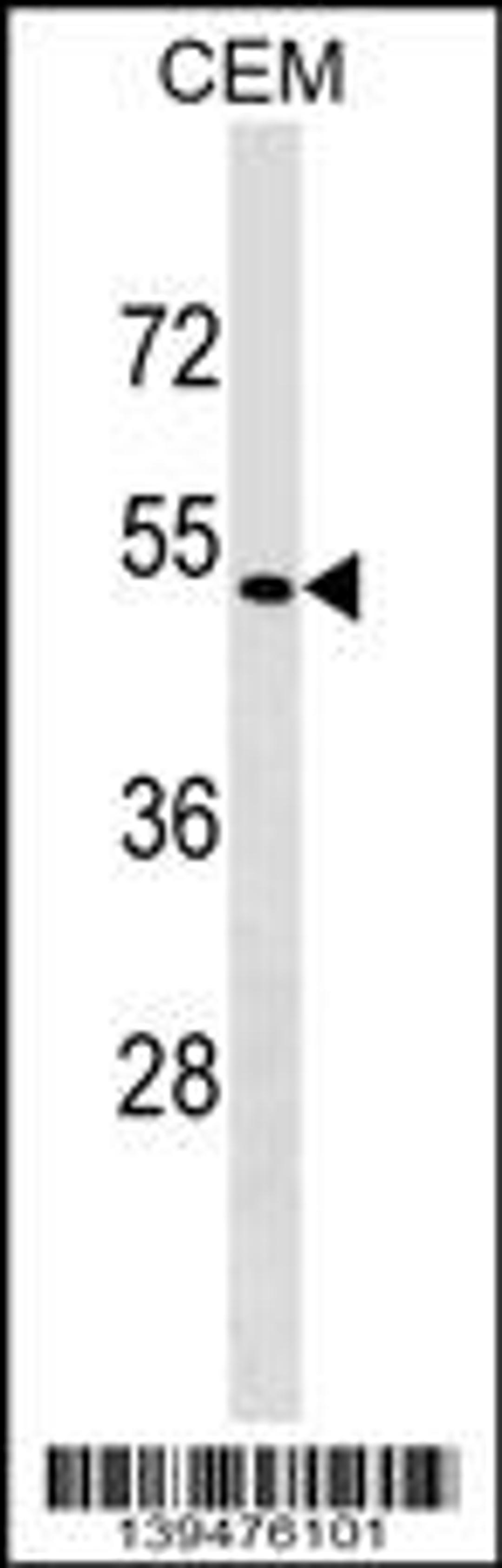 Western blot analysis in CEM cell line lysates (35ug/lane).