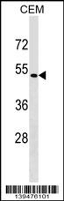 Western blot analysis in CEM cell line lysates (35ug/lane).