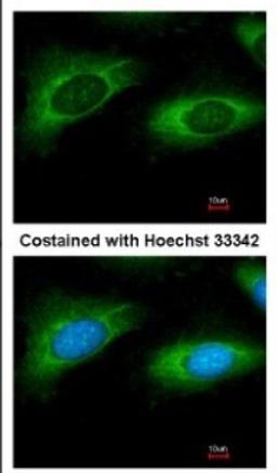 Immunocytochemistry/Immunofluorescence: RPL9 Antibody [NBP2-20219] - Immunofluorescence analysis of methanol-fixed HeLa, using antibody at 1:200 dilution.