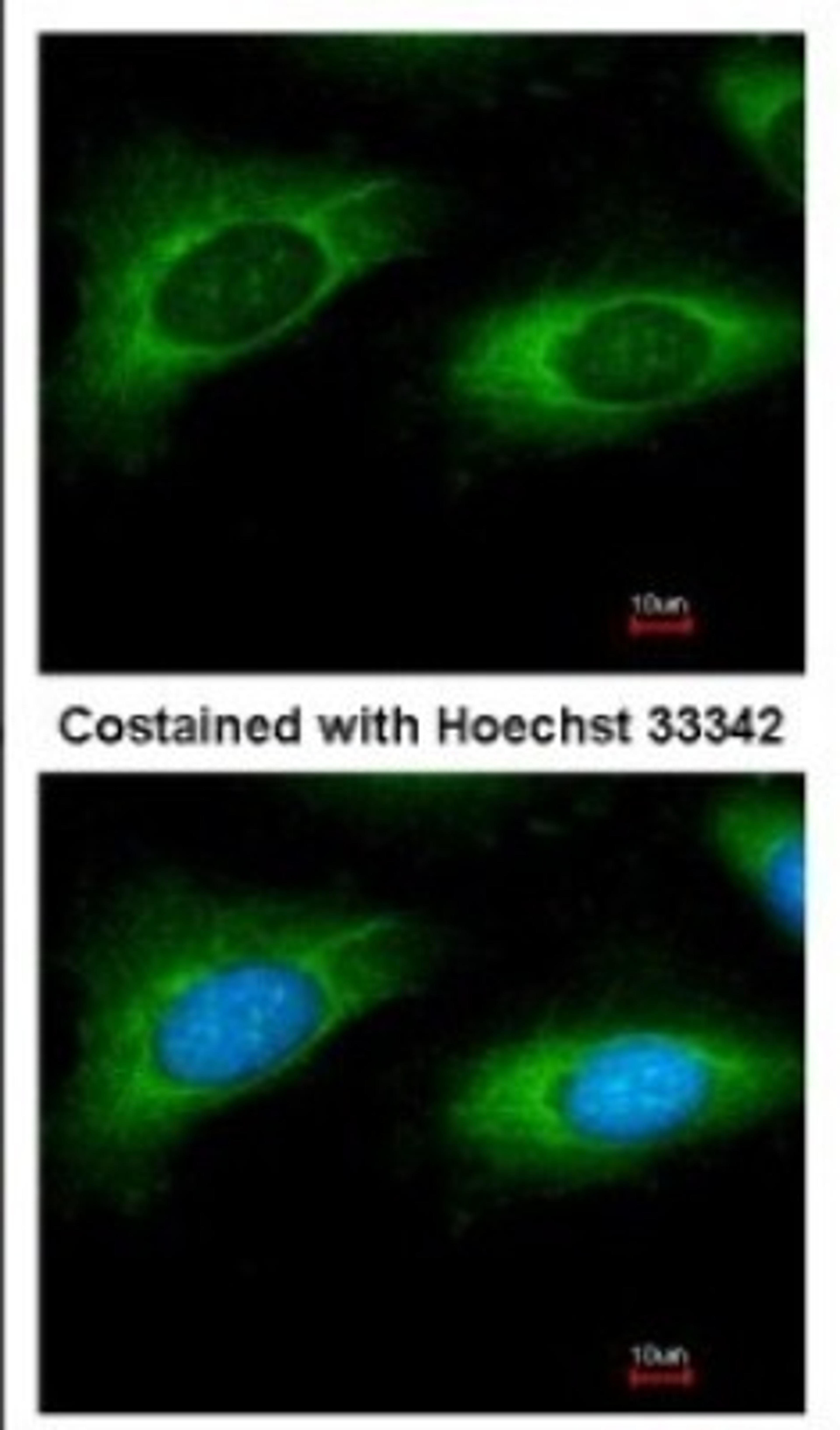 Immunocytochemistry/Immunofluorescence: RPL9 Antibody [NBP2-20219] - Immunofluorescence analysis of methanol-fixed HeLa, using antibody at 1:200 dilution.