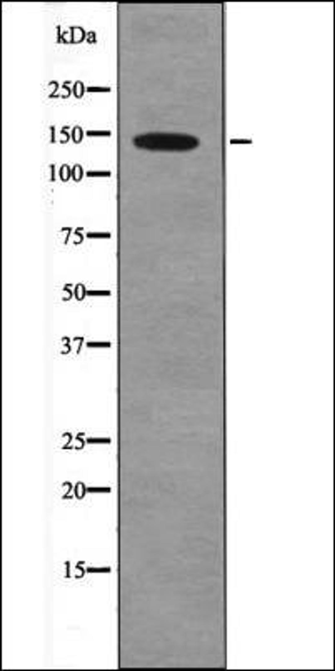 Western blot analysis of HepG2 whole cell lysates using PDGFRa -Phospho-Tyr1018- antibody