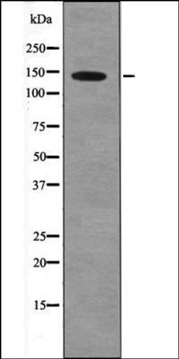 Western blot analysis of HepG2 whole cell lysates using PDGFRa -Phospho-Tyr1018- antibody