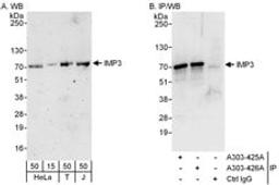 Detection of human IMP3 by western blot and immunoprecipitation.