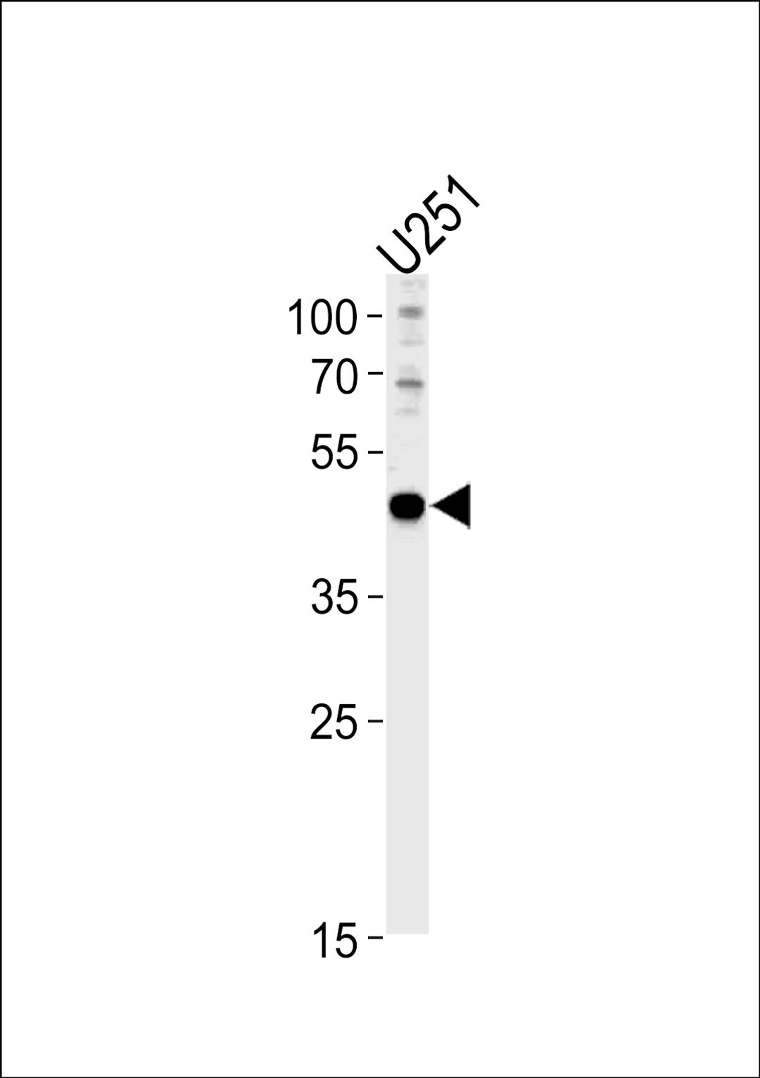 Western blot analysis in U251 cell line lysates (35ug/lane).