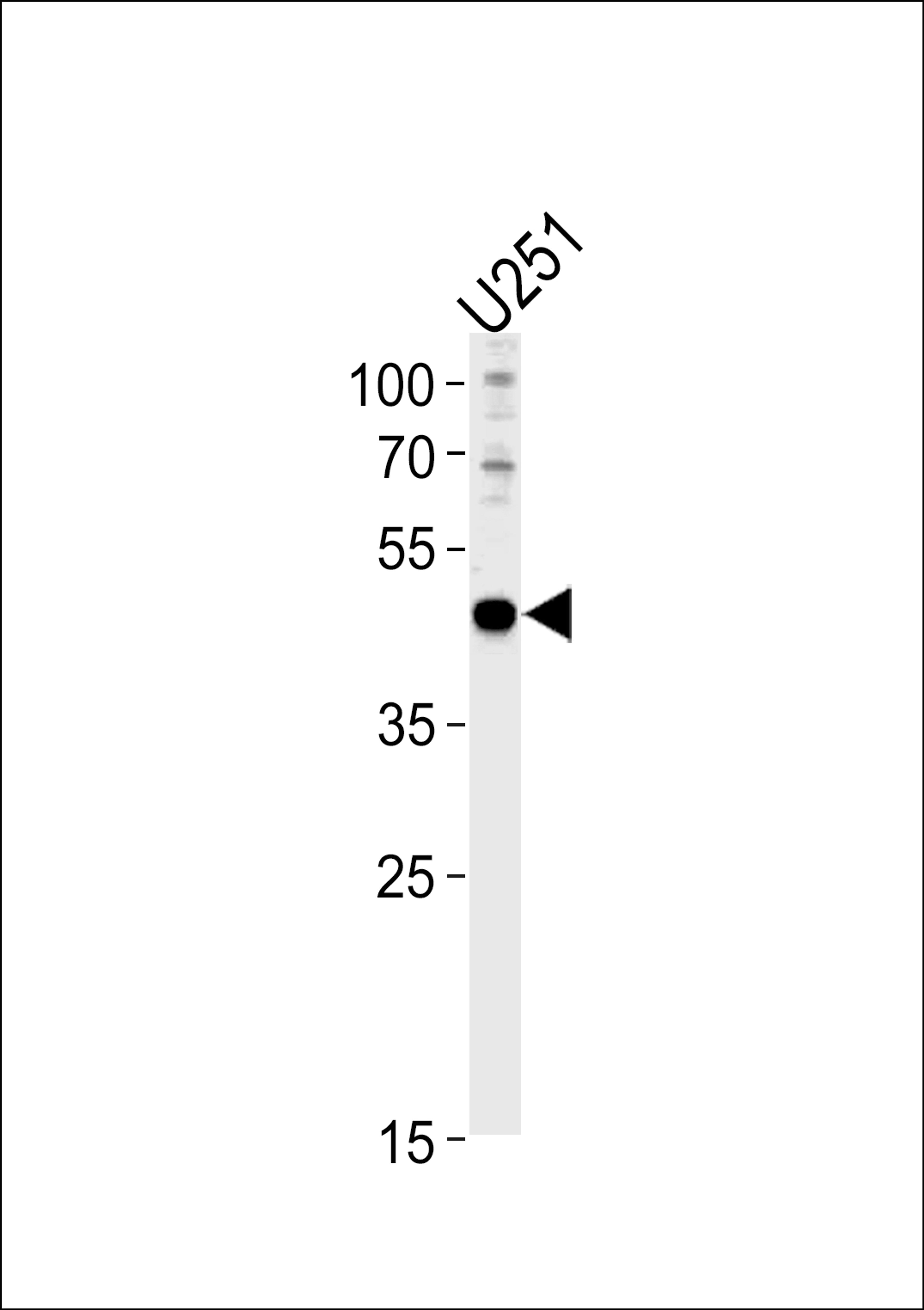 Western blot analysis in U251 cell line lysates (35ug/lane).