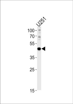 Western blot analysis in U251 cell line lysates (35ug/lane).
