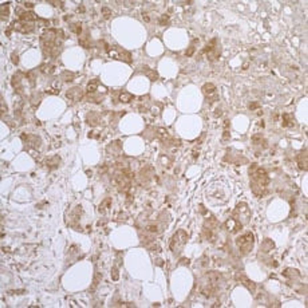 Detection of human HSP27 by immunohistochemistry.