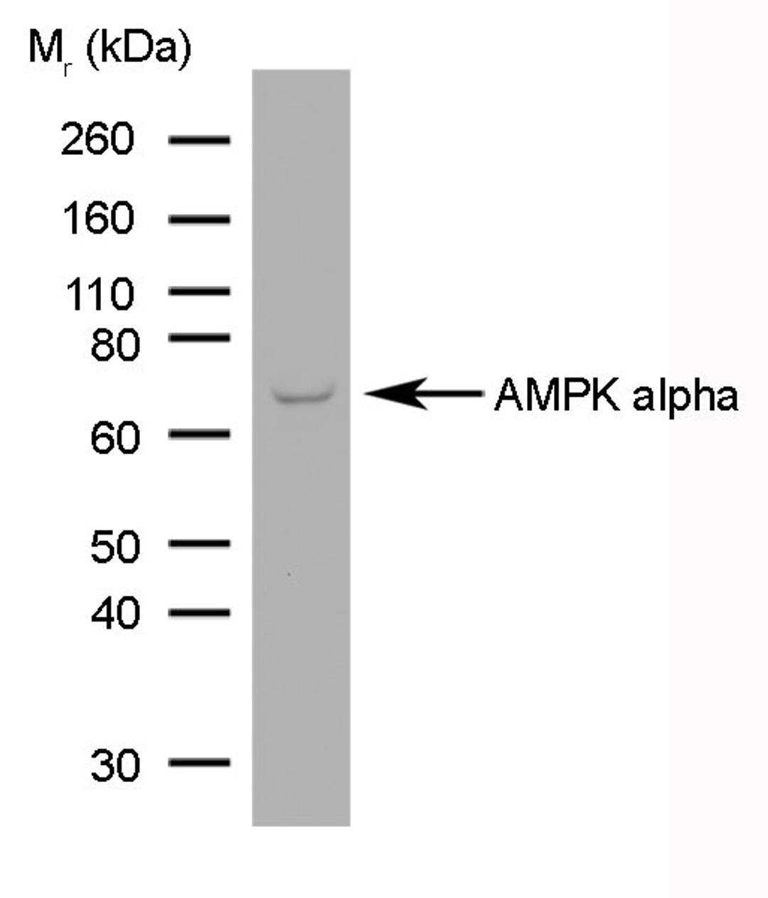 Human brain tumour lysate probed with Mouse anti AMPK alpha 1/2 (MCA2672GA)