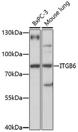 Western blot - ITGB6 antibody (A16904)