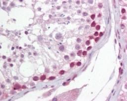 Immunohistochemistry-Paraffin: uracil-DNA glycosylase Antibody [NB600-1031] - Analysis of human testis using this antibody at 10 ug/ml.