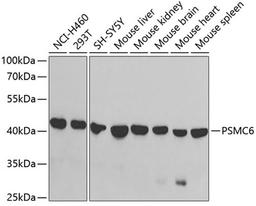 Western blot - PSMC6 antibody (A5377)