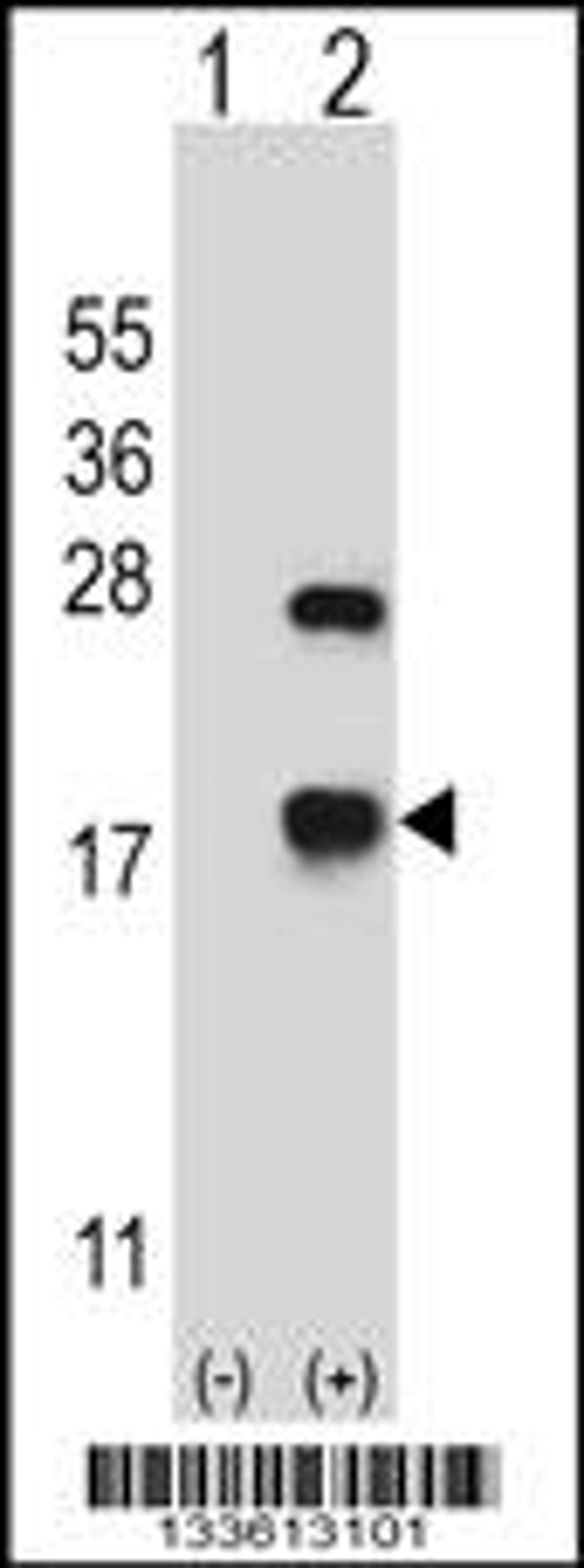 Western blot analysis of CRYAB using rabbit polyclonal CRYAB Antibody using 293 cell lysates (2 ug/lane) either nontransfected (Lane 1) or transiently transfected (Lane 2) with the CRYAB gene.