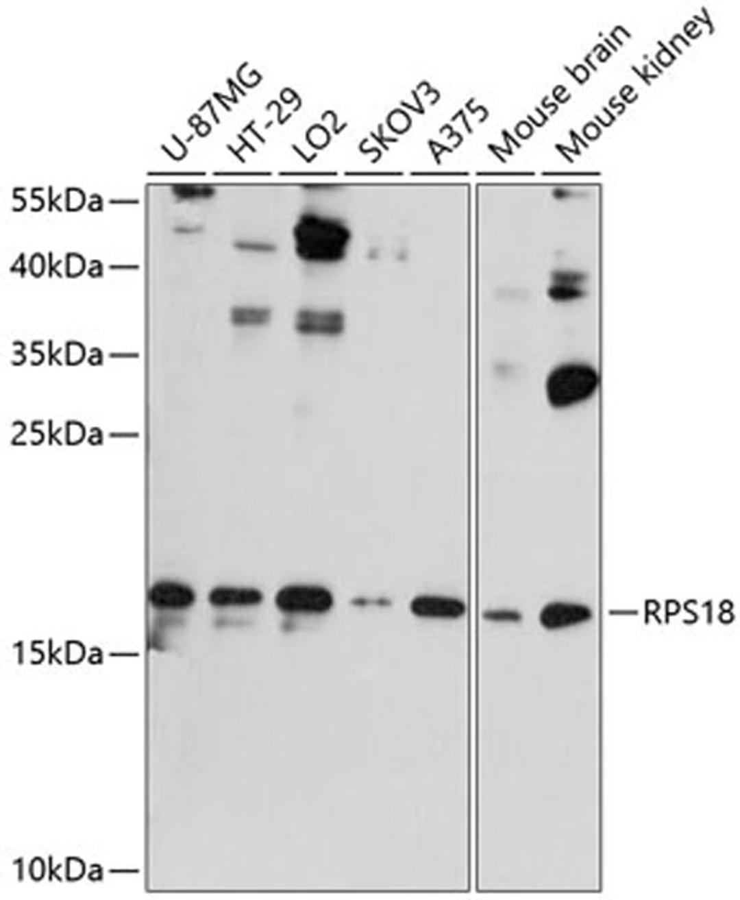 Western blot - RPS18 antibody (A11687)