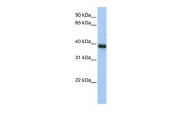 Antibody used in WB on Human HepG2 at 0.2-1 ug/ml.