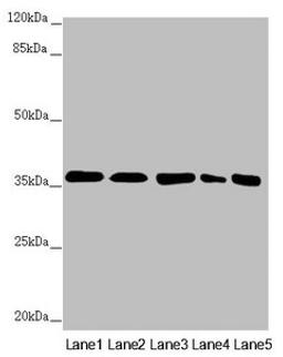 Western blot. All lanes: GNB2 antibody at 2.22µg/ml. Lane 1: Mouse lung tissue. Lane 2: NIH/3T3 whole cell lysate. Lane 3: Jurkat whole cell lysate. Lane 4: 293T whole cell lysate. Lane 5: Hela whole cell lysate. Secondary. Goat polyclonal to rabbit IgG at 1/10000 dilution. Predicted band size: 38, 26 kDa. Observed band size: 38 kDa