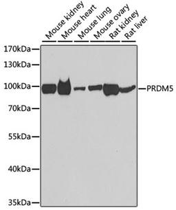 Western blot - PRDM5 antibody (A7361)