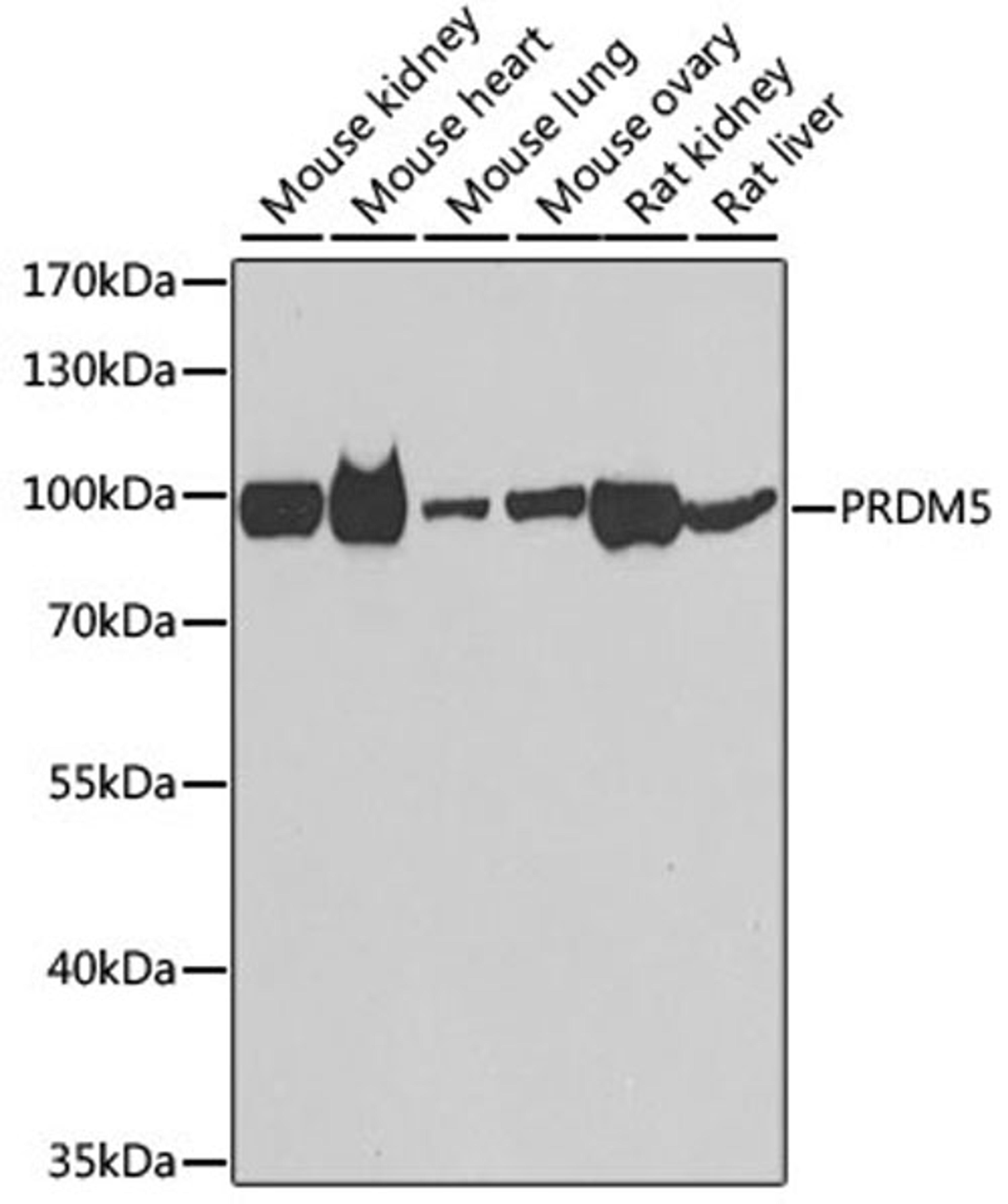 Western blot - PRDM5 antibody (A7361)