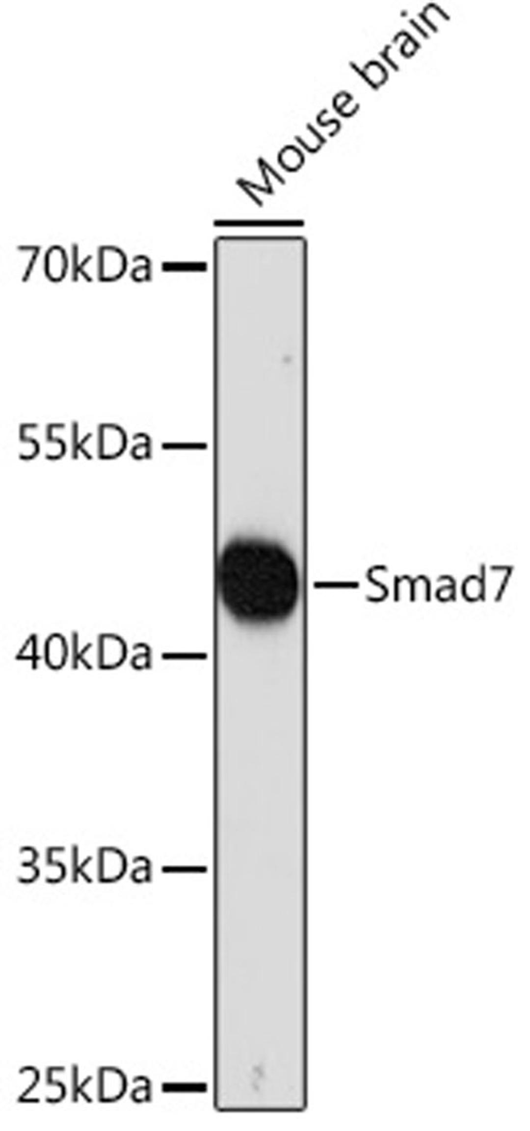 Western blot - Smad7 Rabbit pAb (A16396)