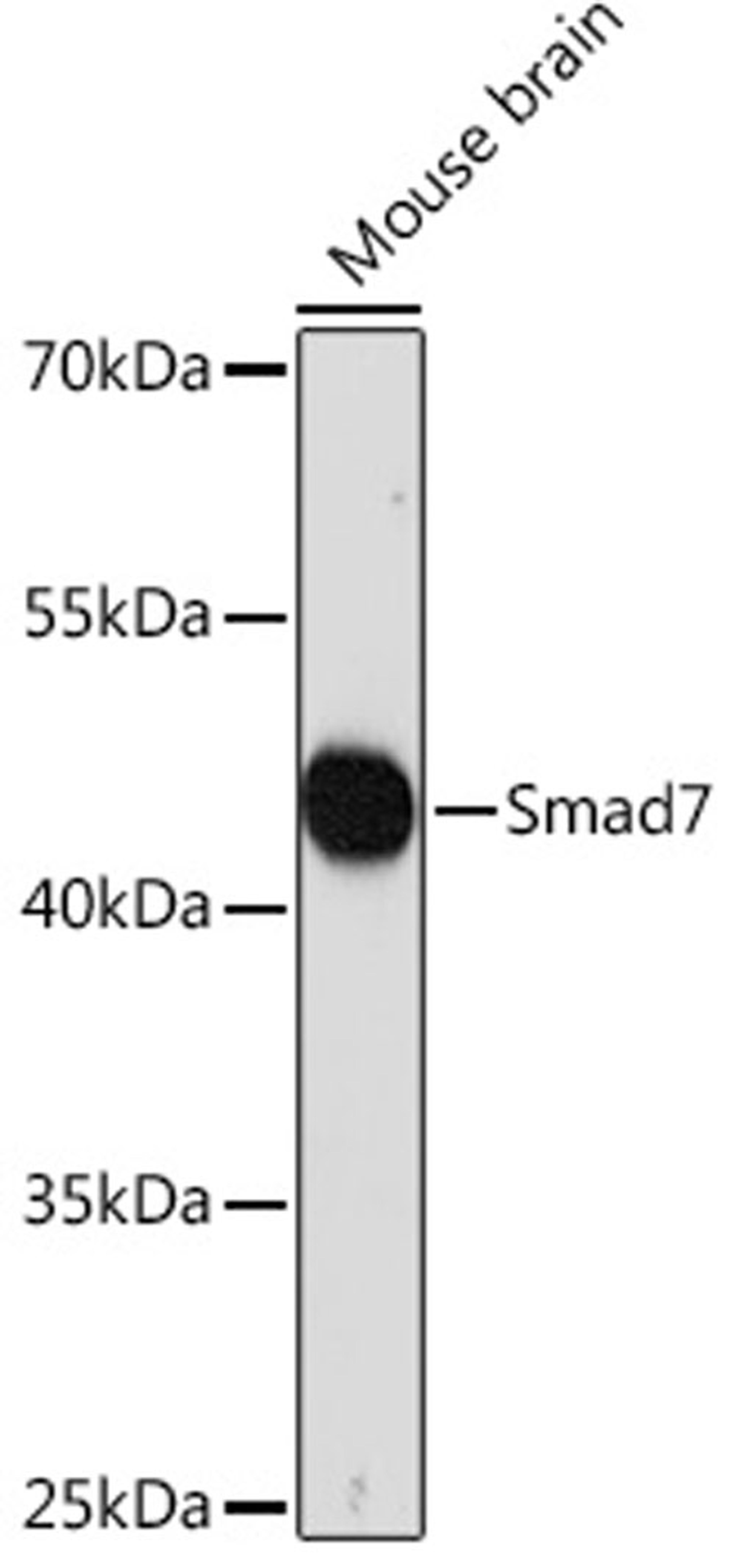 Western blot - Smad7 Rabbit pAb (A16396)