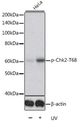 Western blot - Phospho-Chk2-T68 antibody (AP0590)