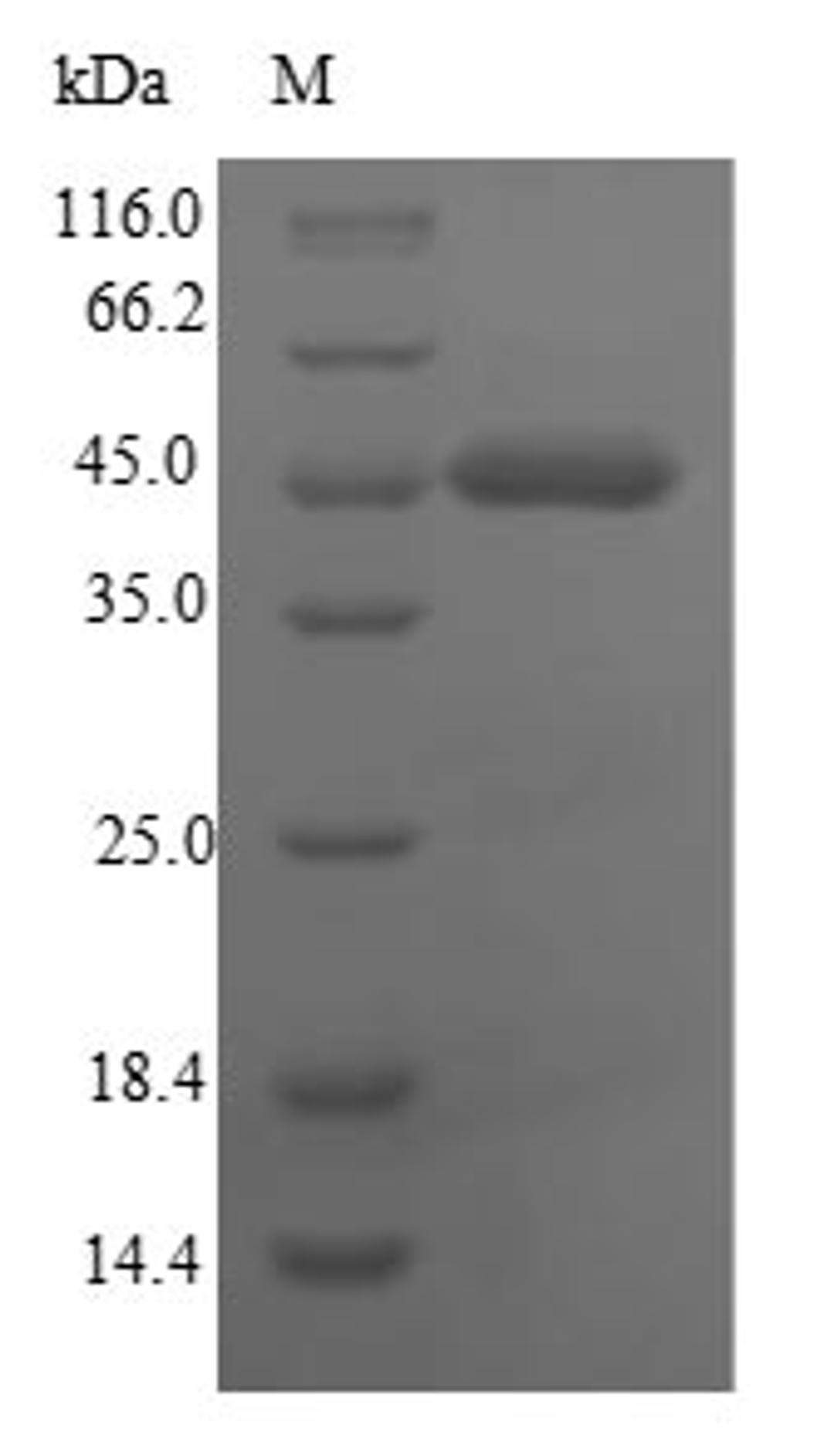 (Tris-Glycine gel) Discontinuous SDS-PAGE (reduced) with 5% enrichment gel and 15% separation gel.