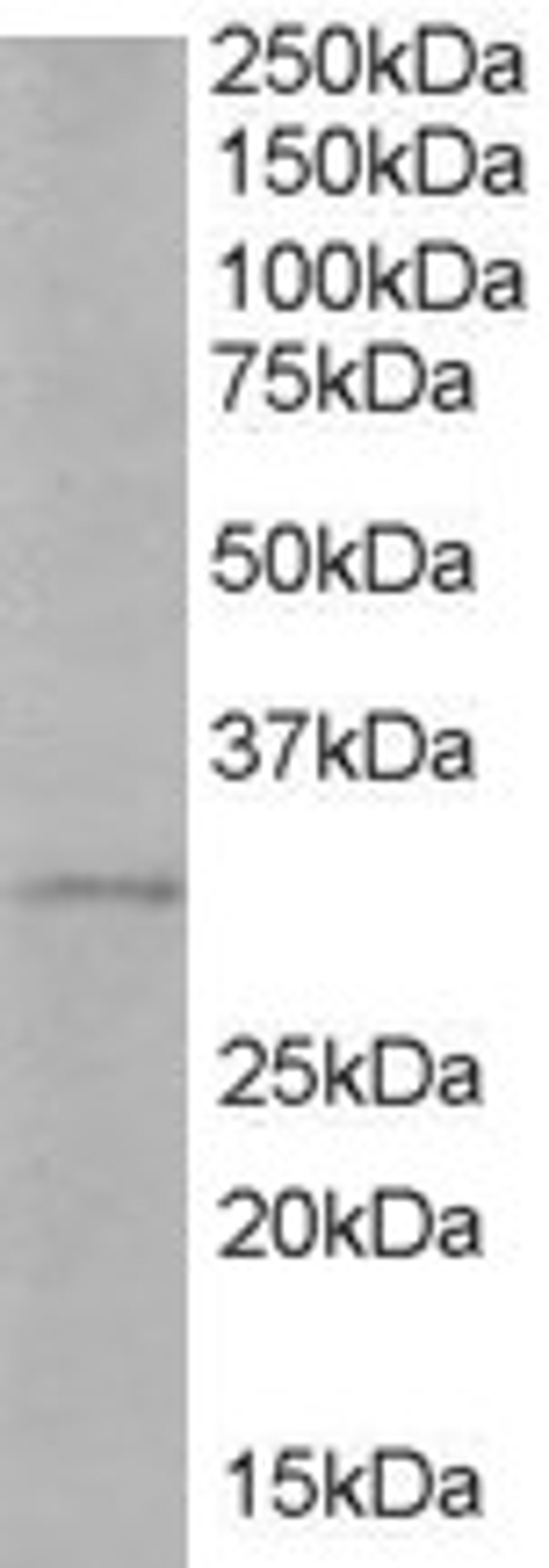 46-500 (1ug/ml) staining of Human Liver lysate (35ug protein in RIPA buffer). Primary incubation was 1 hour. Detected by chemiluminescence.