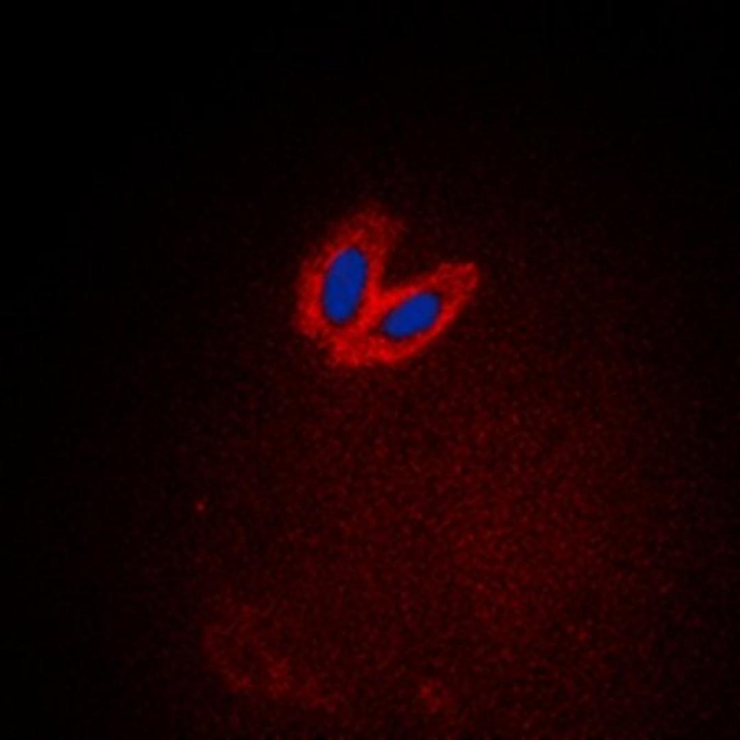 Immunofluorescense analysis of HeLa cells using ACK1 (phospho-Y284) antibody