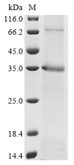 (Tris-Glycine gel) Discontinuous SDS-PAGE (reduced) with 5% enrichment gel and 15% separation gel.