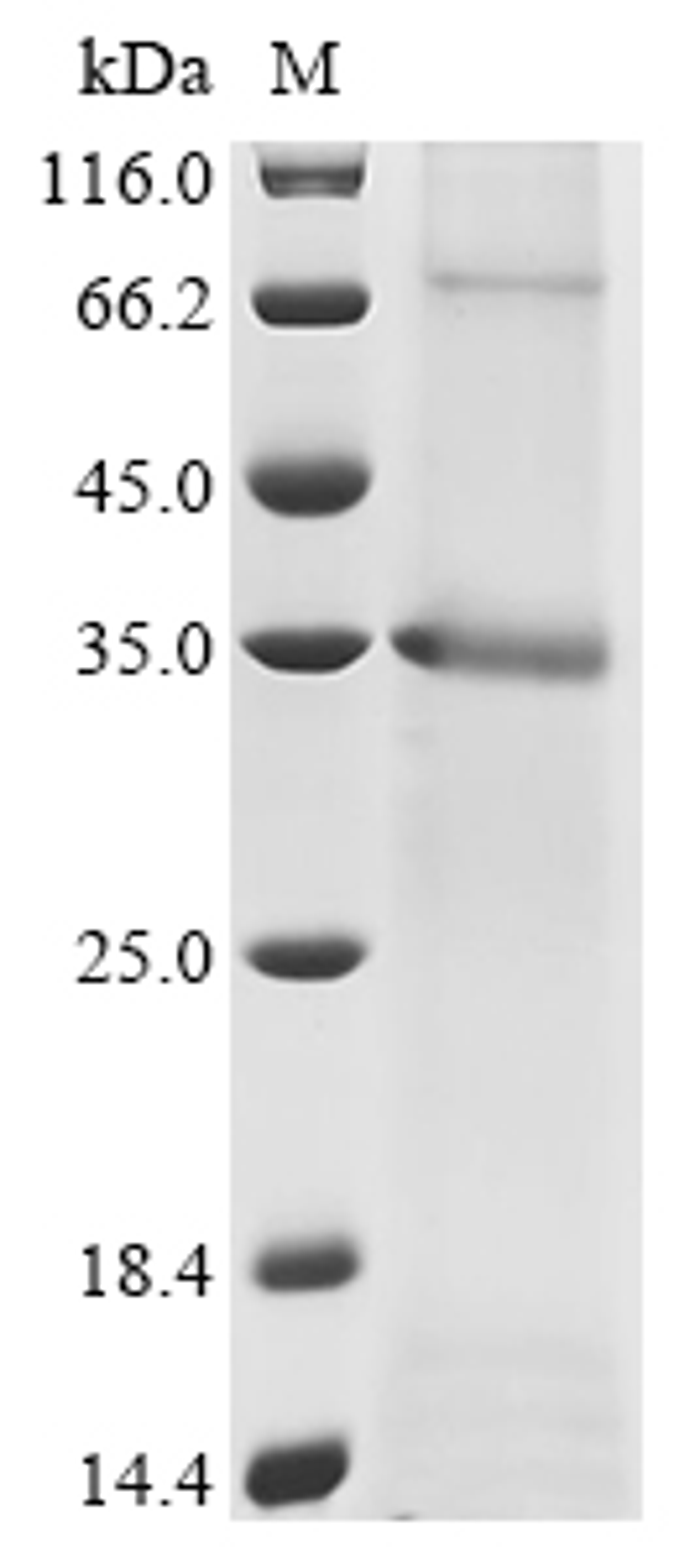 (Tris-Glycine gel) Discontinuous SDS-PAGE (reduced) with 5% enrichment gel and 15% separation gel.