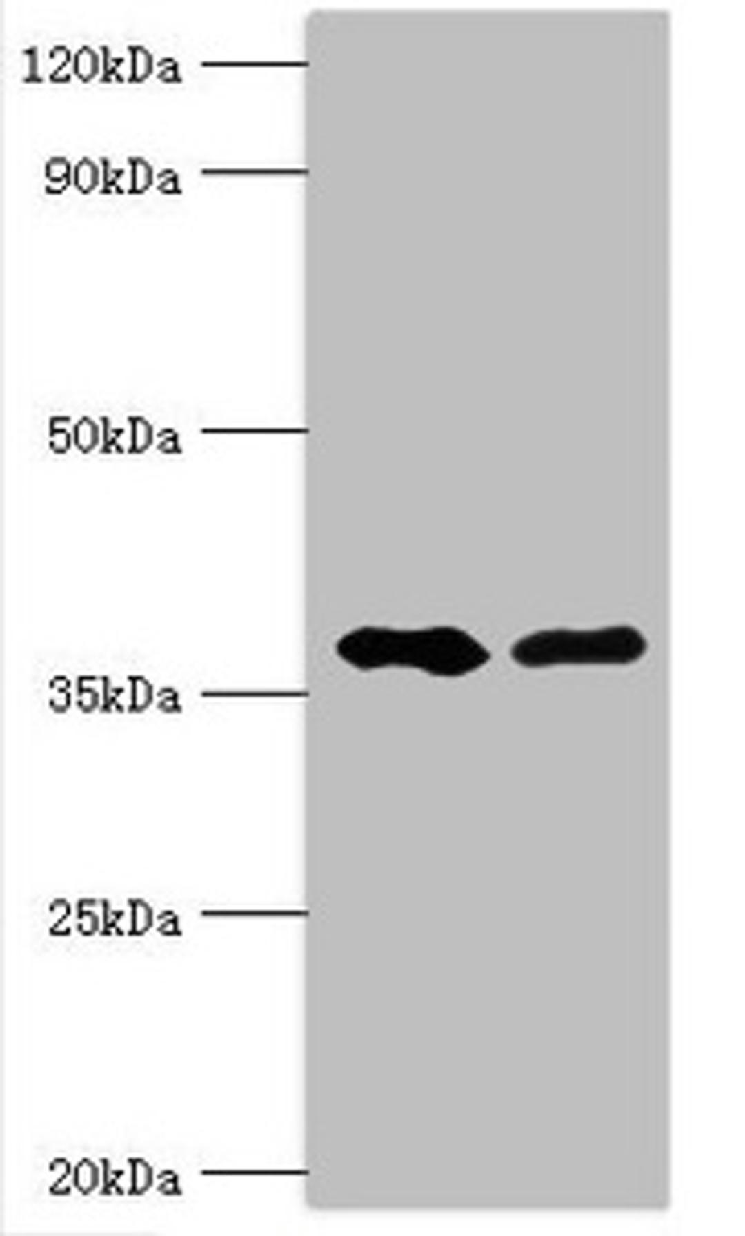 Western blot. All lanes: Methylglutaconyl-CoA hydratase, mitochondrial antibody at 6ug/ml. Lane 1: Rat brain tissue. Lane 2: Rat kidney tissue. Secondary. Goat polyclonal to rabbit IgG at 1/10000 dilution. Predicted band size: 36, 33 kDa. Observed band size: 36 kDa.