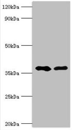 Western blot. All lanes: Methylglutaconyl-CoA hydratase, mitochondrial antibody at 6ug/ml. Lane 1: Rat brain tissue. Lane 2: Rat kidney tissue. Secondary. Goat polyclonal to rabbit IgG at 1/10000 dilution. Predicted band size: 36, 33 kDa. Observed band size: 36 kDa.