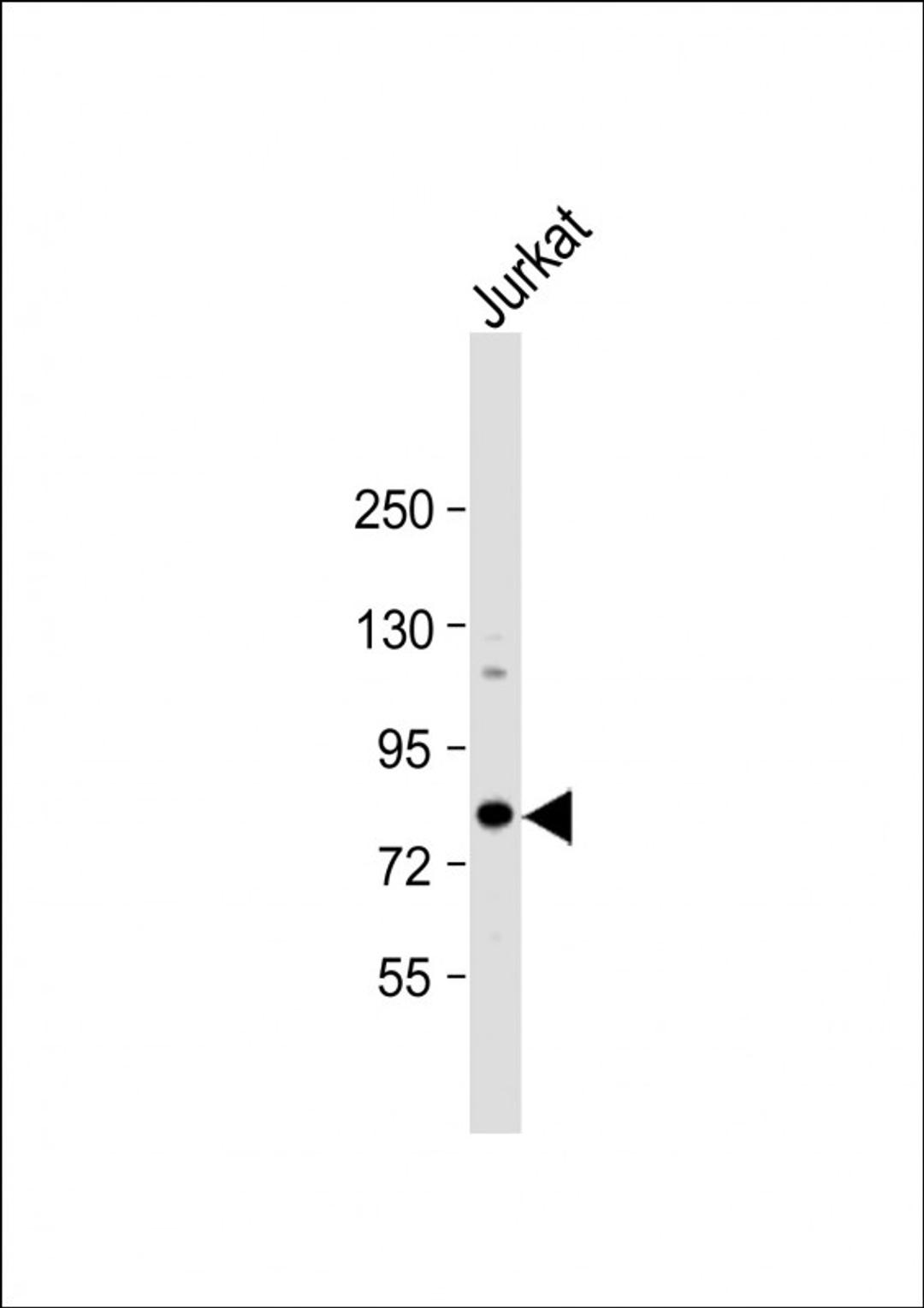 Western Blot at 1:1000 dilution + Jurkat whole cell lysate Lysates/proteins at 20 ug per lane.