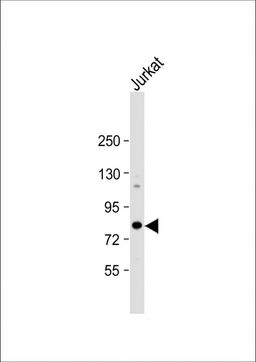 Western Blot at 1:1000 dilution + Jurkat whole cell lysate Lysates/proteins at 20 ug per lane.