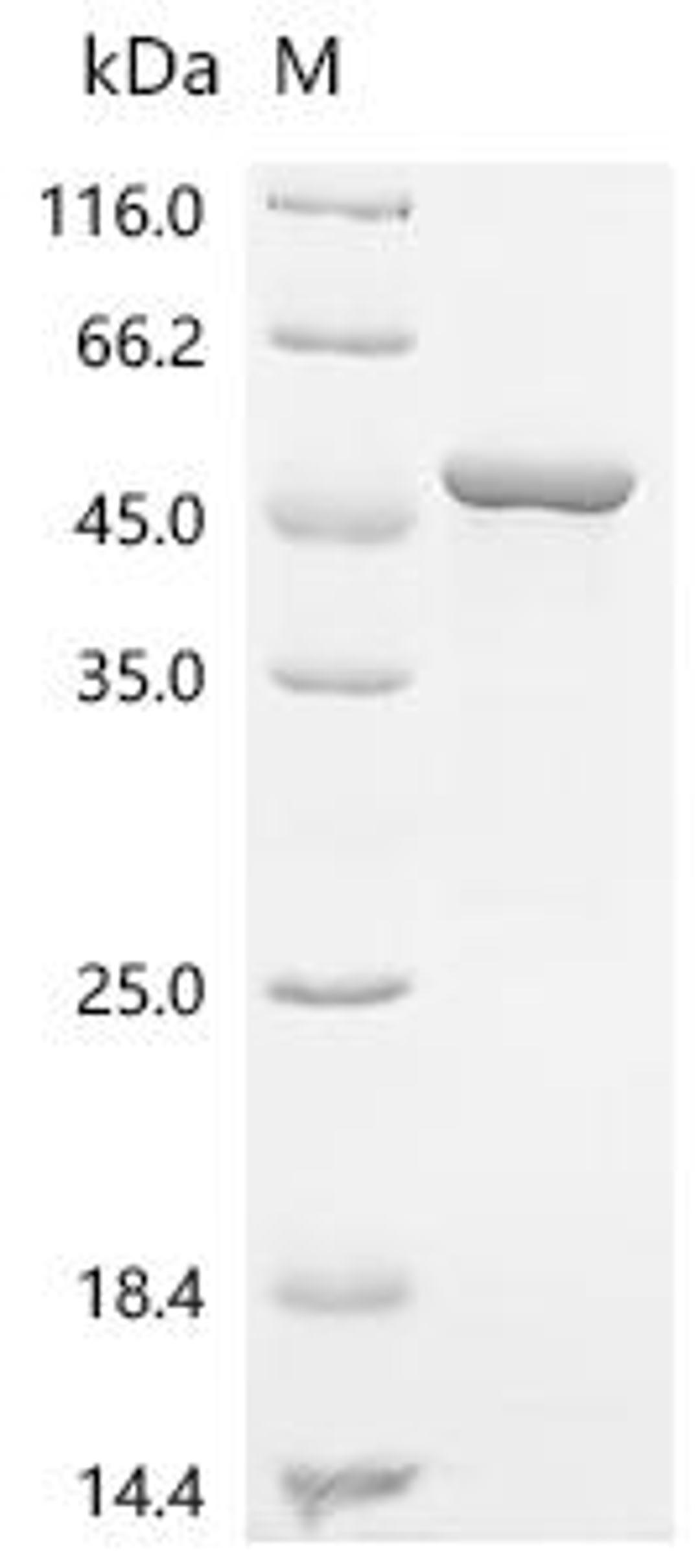(Tris-Glycine gel) Discontinuous SDS-PAGE (reduced) with 5% enrichment gel and 15% separation gel.