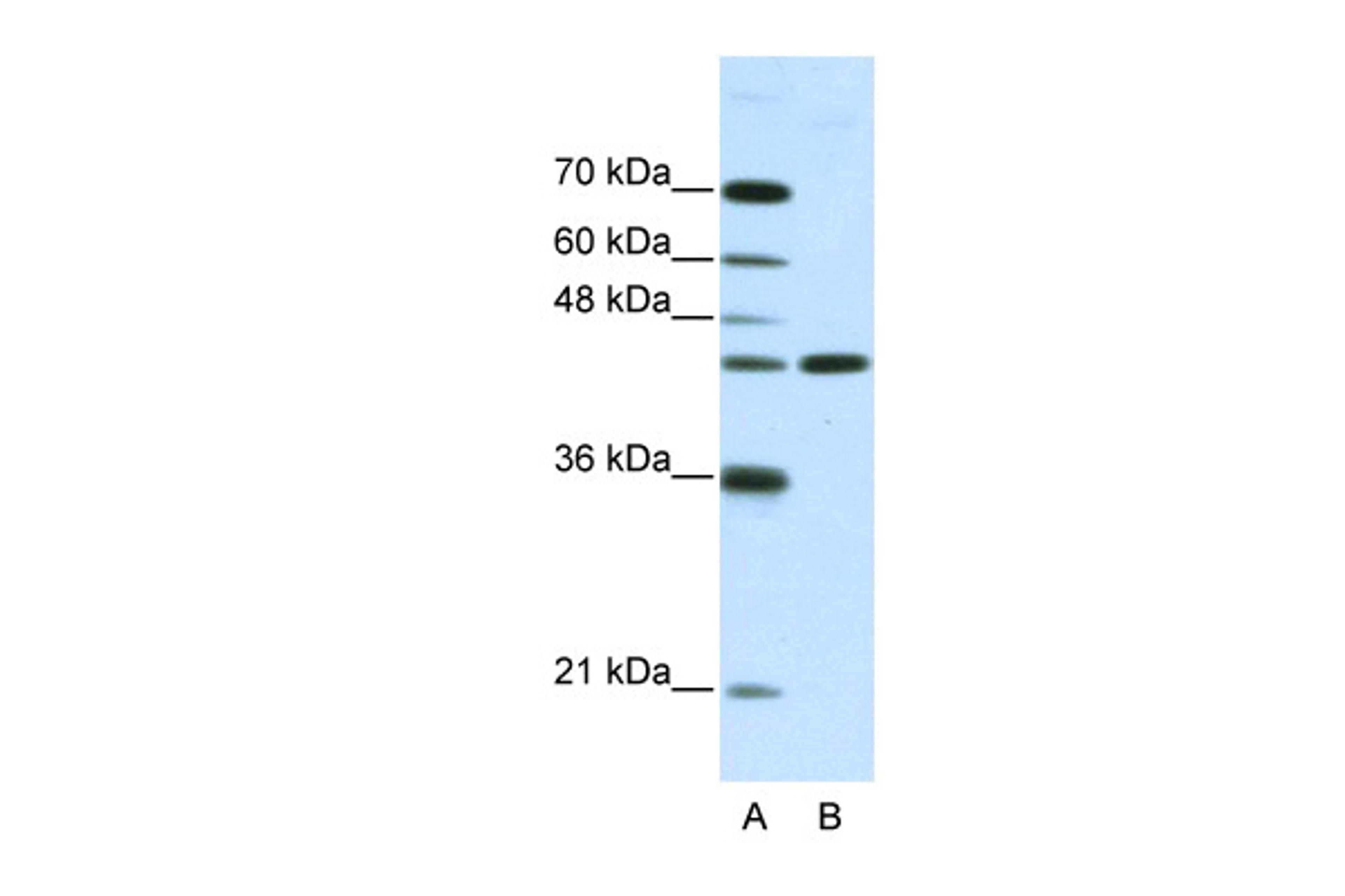 Antibody used in WB on Human HepG2 at 2.5 ug/ml.