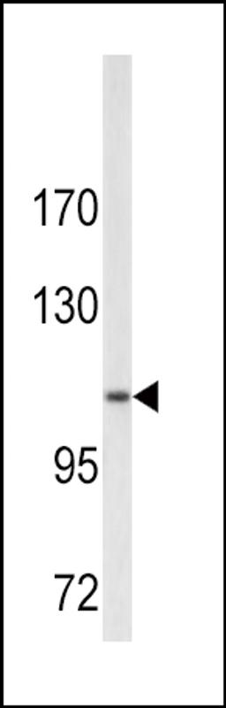 Western blot analysis of COL6A1 antibody in A2058 cell line lysates (35ug/lane)