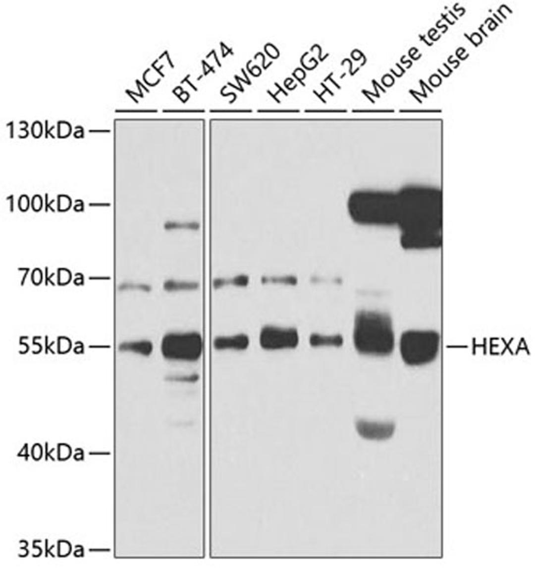 Western blot - HEXA antibody (A5646)