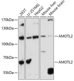 Western blot - AMOTL2 antibody (A16723)