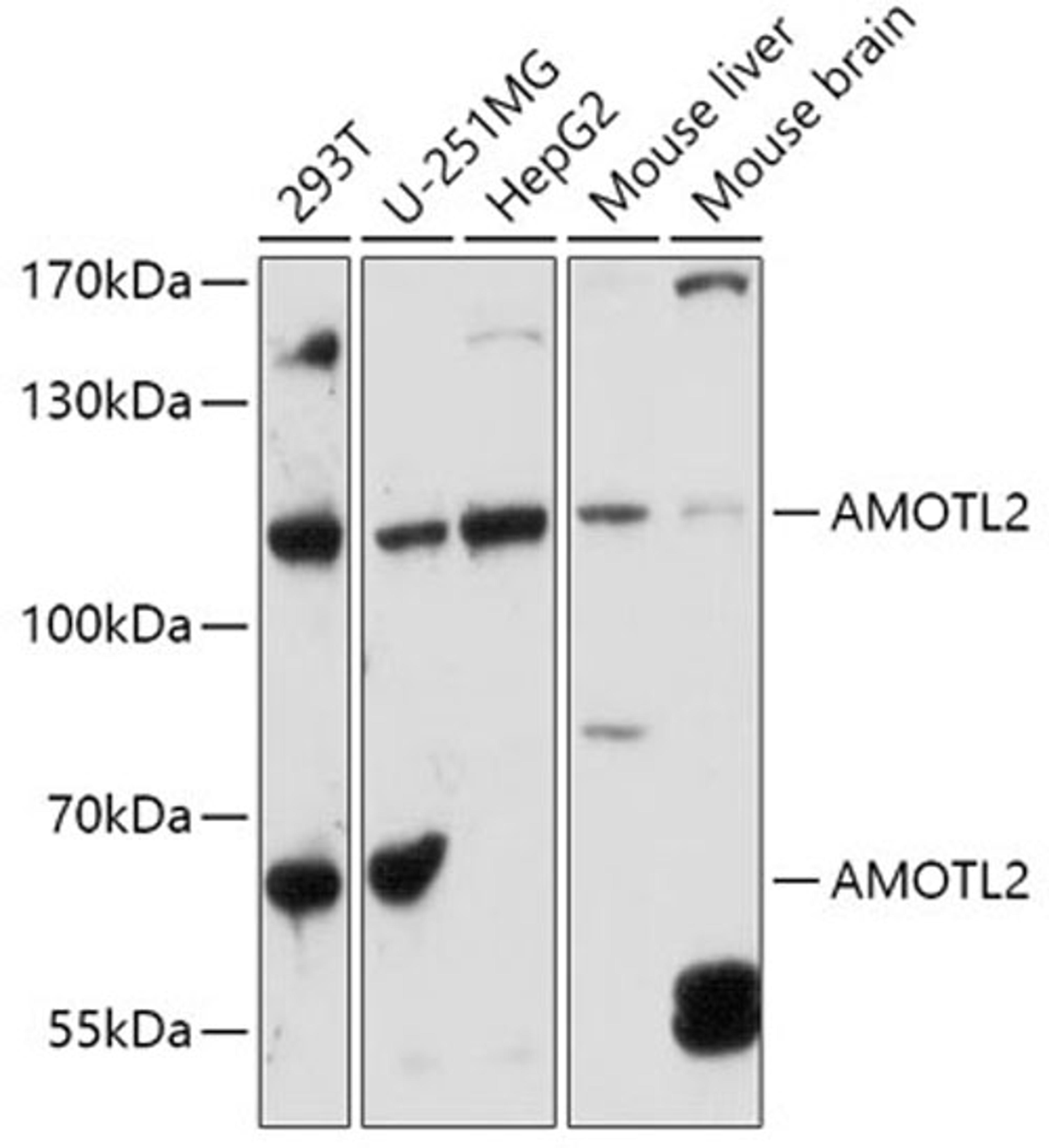 Western blot - AMOTL2 antibody (A16723)